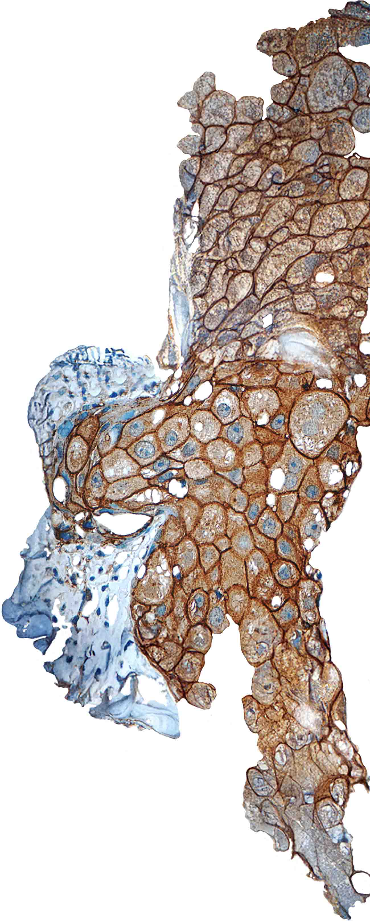 Vista microscópica de muestra para análisis patológico, con formas circulares e irregulares con tonos morados.