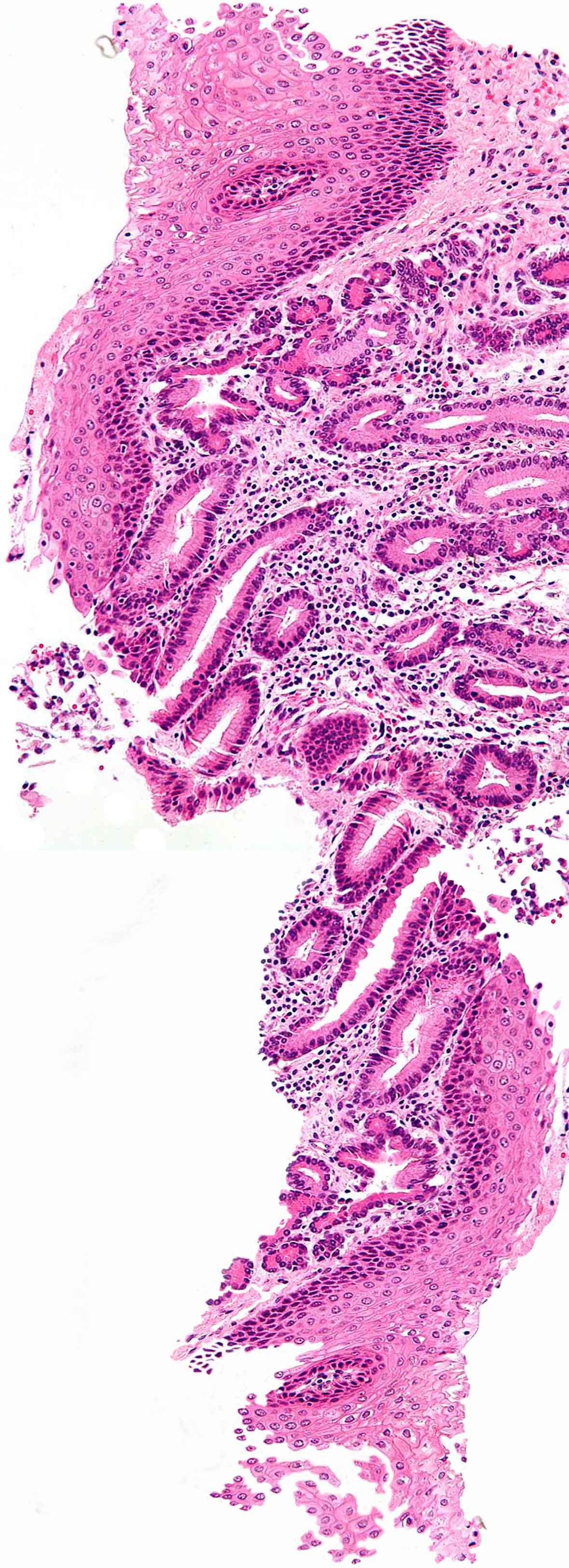 Vista microscópica de muestra para análisis patológico, con formas circulares e irregulares con tonos morados.