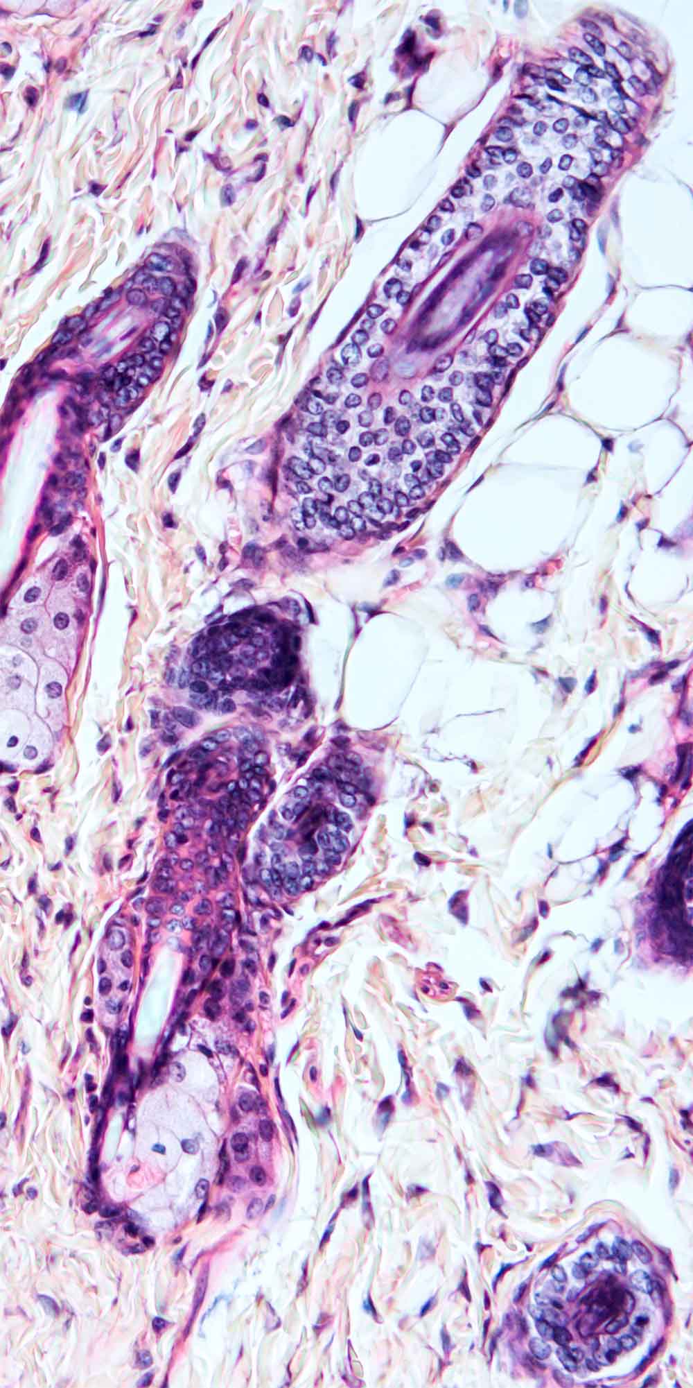 Vista microscópica de muestra para análisis patológico, con formas circulares e irregulares con tonos morados y azules.