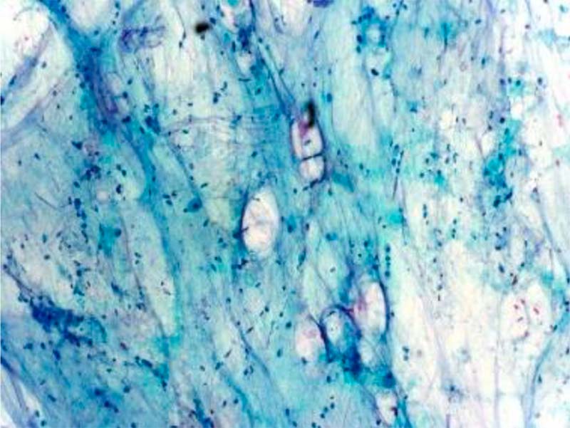 Muestra vista desde un microscopio; esta tiene formas irregulares y curvas. 