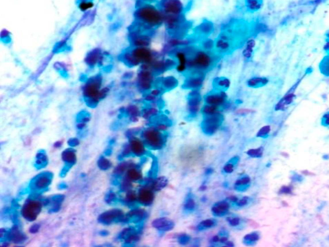 Muestra vista desde un microscopio; esta tiene formas irregulares y curvas. 