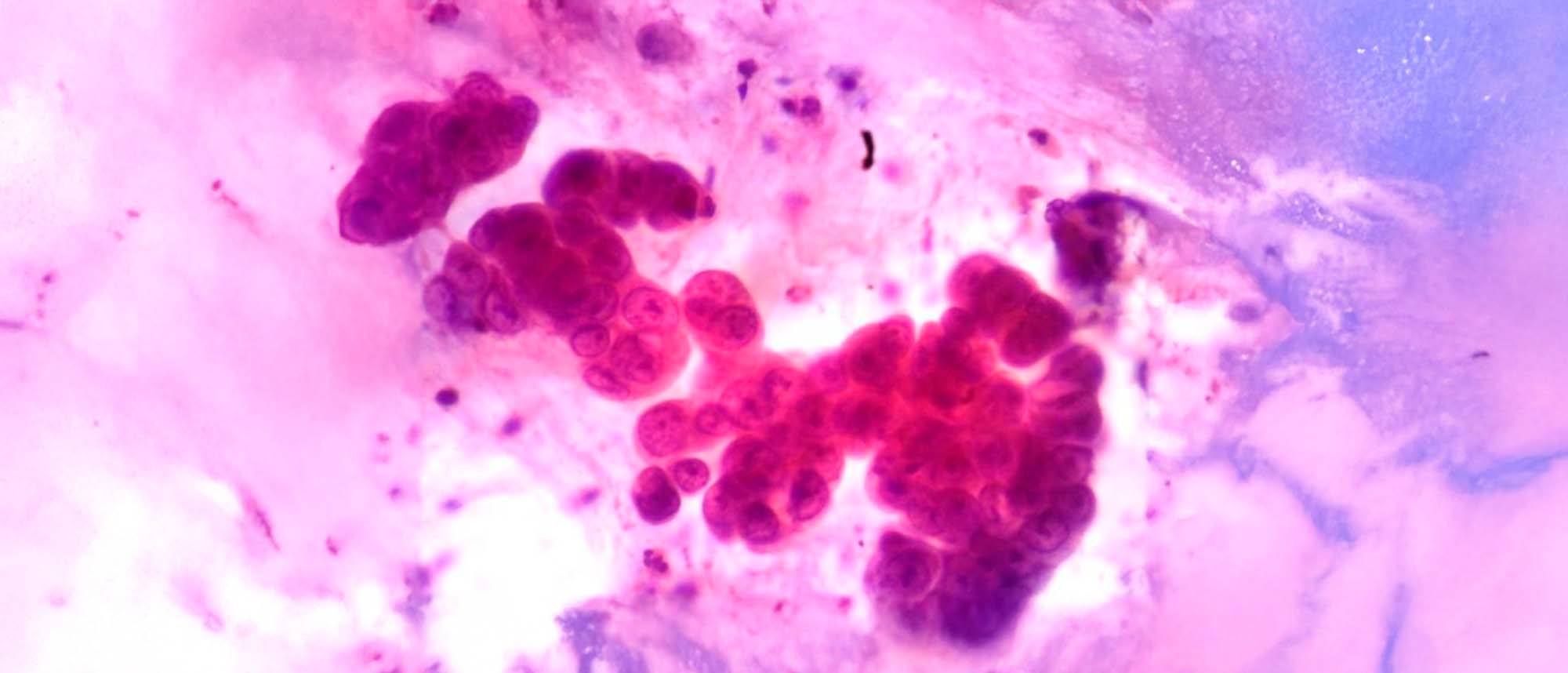 Muestra vista desde un microscopio; esta tiene formas irregulares y curvas.