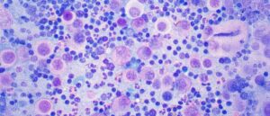 Citología oncológica.